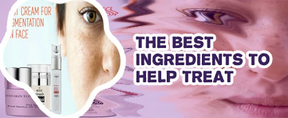 Best korean products for pigmentation