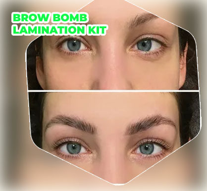 Brow bomb lamination