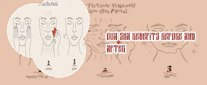 Guasha before and after